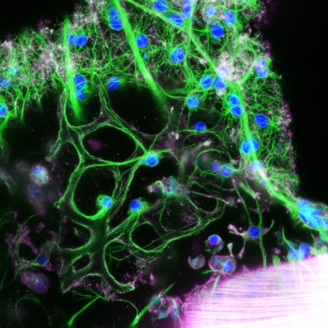 Confocal maximum-intensity projection: a branched cellular network, with nuclei distributed along its strands.